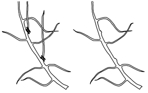 Shoots before and after pruning