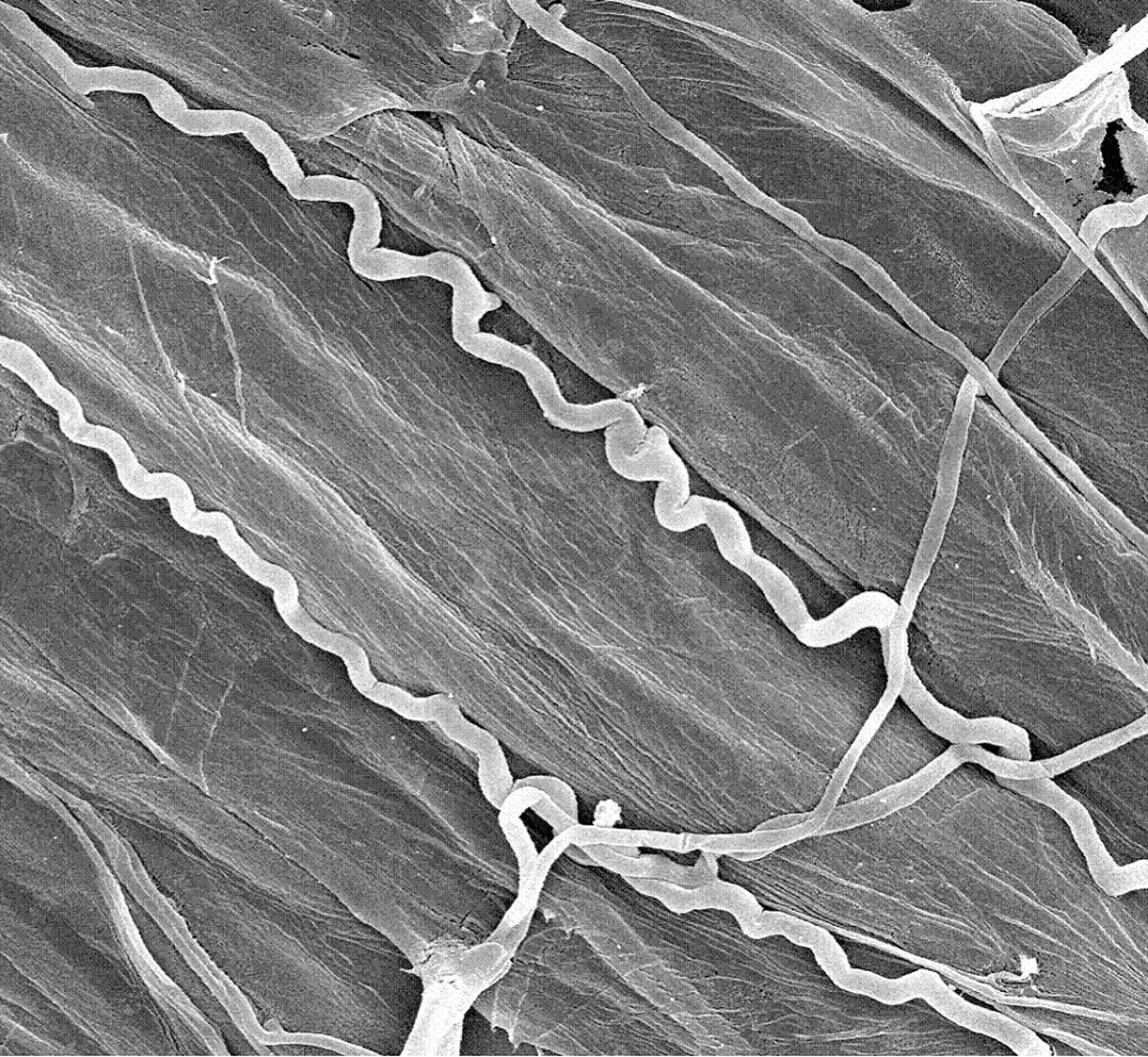 Slender tubes of the endophytic fungus