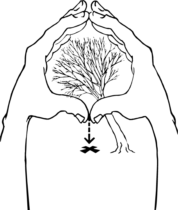 Las manos se levantan rodeando la copa de un árbol con los pulgares apretados, apuntando directamente hacia abajo, para ayudar a determinar la inclinación del árbol como se describe en la leyenda.