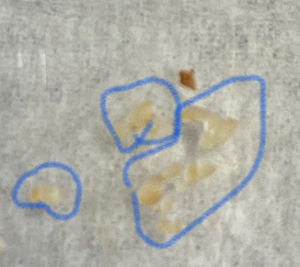 a photo of a set of undeveloped pale blueberry seeds