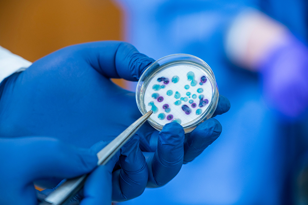 Gloved hands holding a petri dish with bacterial colonies in a lab, highlighting antimicrobial resistance research.